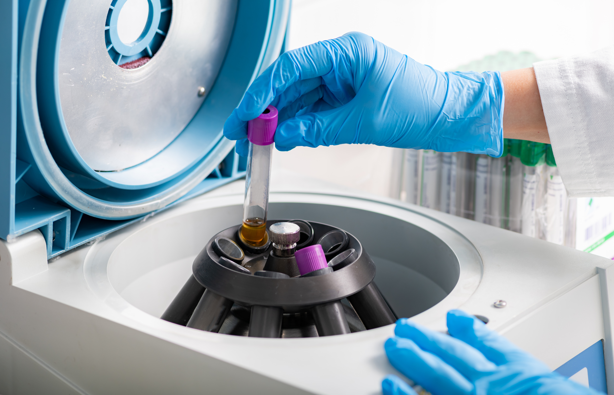 Lab samples spinning in centrifuge
